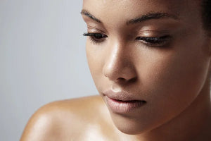 Natural Ingredients to Treat Oily Skin