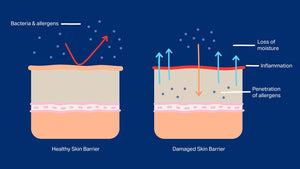 Let's Talk About Your Skin's Barrier
